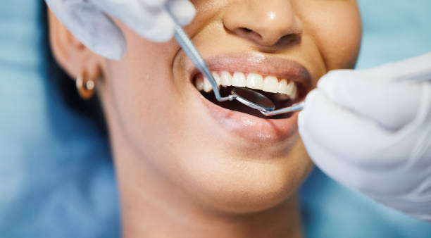 Best Emergency Tooth Extraction in Sharpes, FL